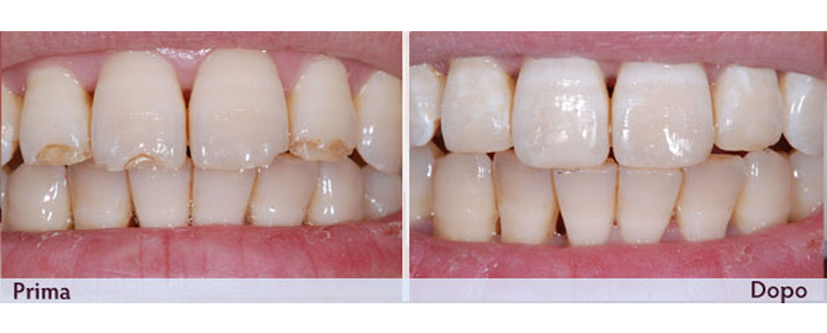 ODONTOIATRIA CONSERVATIVA